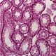 Portable Measuring Microscope